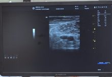 Photo of Hitna pomoć KS bogatija sa novim ultrazvučnim aparatom